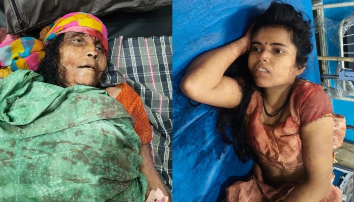 Mother refused to give Rs 200 to buy a dog, son killed her by hitting her on the head with a hammer