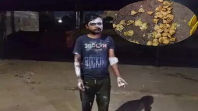 When the drunkard asked for money for the samosas, he poured boiling oil on the businessman, two got burnt
