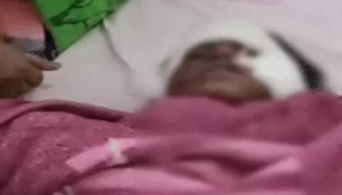 A girl returning from tuition was attacked by dogs, got 70 stitches