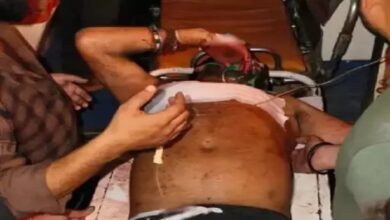 Knife attack in salon, two youths seriously injured