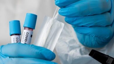 Corona is raising its head again in the country: 2 deaths in 24 hours, 27 new cases, 363 active patients