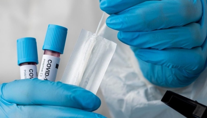 Corona is raising its head again in the country: 2 deaths in 24 hours, 27 new cases, 363 active patients
