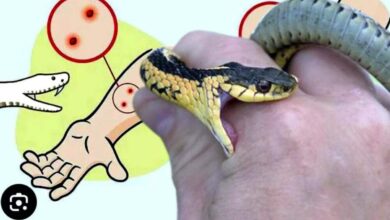 If you get bitten by a snake during rains, do not resort to black magic, go to the hospital immediately: Health Department