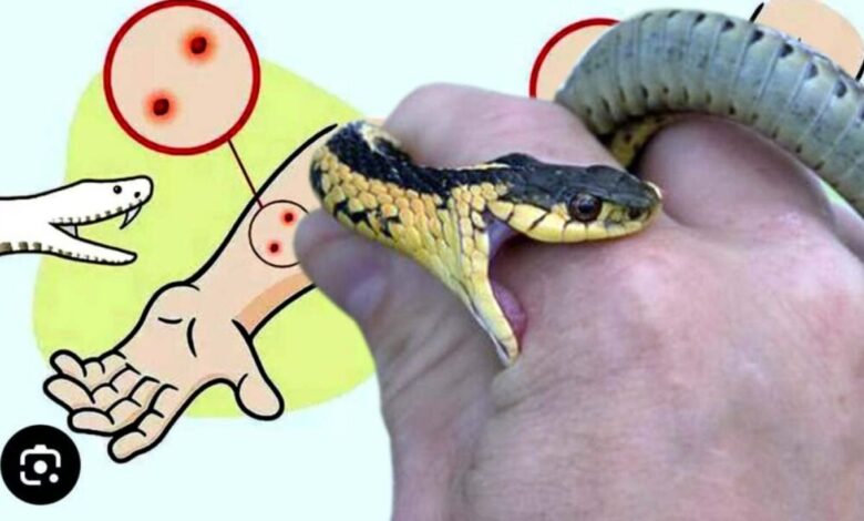 If you get bitten by a snake during rains, do not resort to black magic, go to the hospital immediately: Health Department