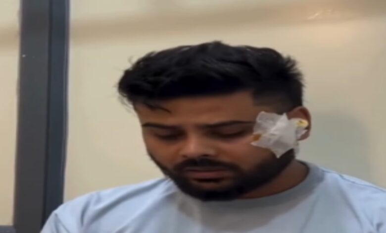 छत्तीसगढ़ी कलाकार स्वप्निल जायसवाल के साथ मारपीट, सोशल मीडिया पर वीडियो शेयर कर लगाए गंभीर आरोप