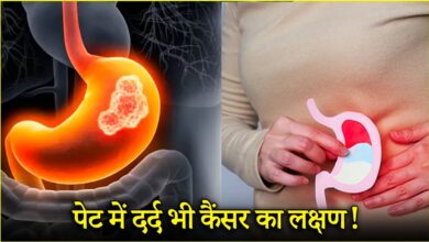 युवाओं में बढ़ रहा पेट के कैंसर का खतरा, डॉक्टर ने बताए 4 बचाव के तरीके