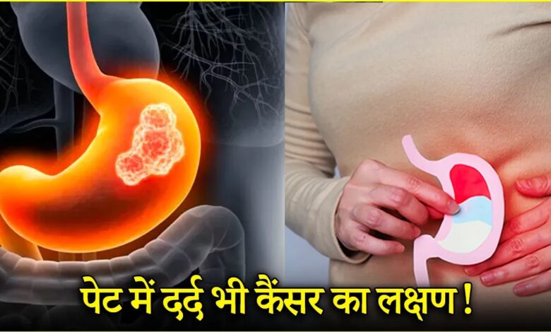 युवाओं में बढ़ रहा पेट के कैंसर का खतरा, डॉक्टर ने बताए 4 बचाव के तरीके