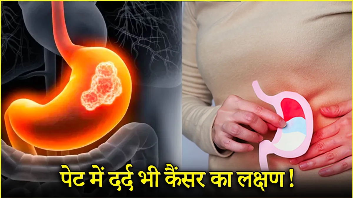 युवाओं में बढ़ रहा पेट के कैंसर का खतरा, डॉक्टर ने बताए 4 बचाव के तरीके