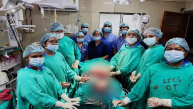 Ambedkar Hospital successfully operated on a rare secondary abdominal pregnancy
