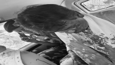 BJP MP attacked, stoned by mob, head fractured; condition critical