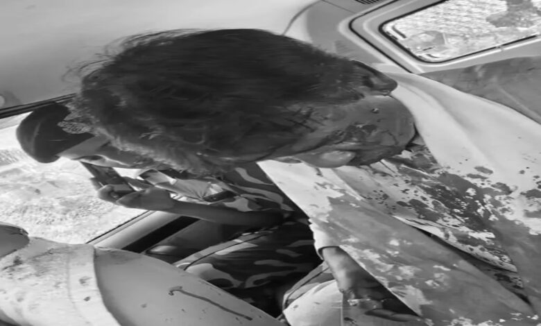 BJP MP attacked, stoned by mob, head fractured; condition critical