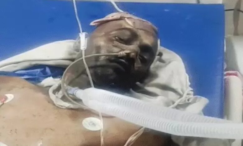 जयपुर SMS हॉस्पिटल आग हादसा: 8 मरीजों की मौत, ICU में शॉर्ट सर्किट की आशंका