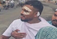 अहमदाबाद हादसा: जिंदा बचे विश्वास बोले, रोज मर रहा हूं: कारोबार ठप