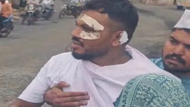 अहमदाबाद हादसा: जिंदा बचे विश्वास बोले, रोज मर रहा हूं: कारोबार ठप