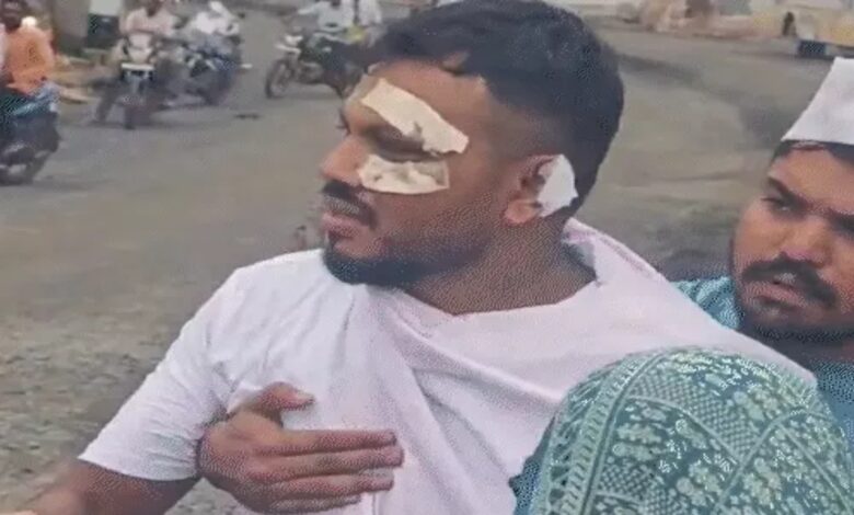 अहमदाबाद हादसा: जिंदा बचे विश्वास बोले, रोज मर रहा हूं: कारोबार ठप