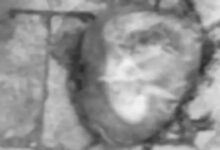 मेकाहारा रायपुर में कचरे के पास मिला भ्रूण: दो संदिग्ध CCTV में कैद, पुलिस जांच में जुटी