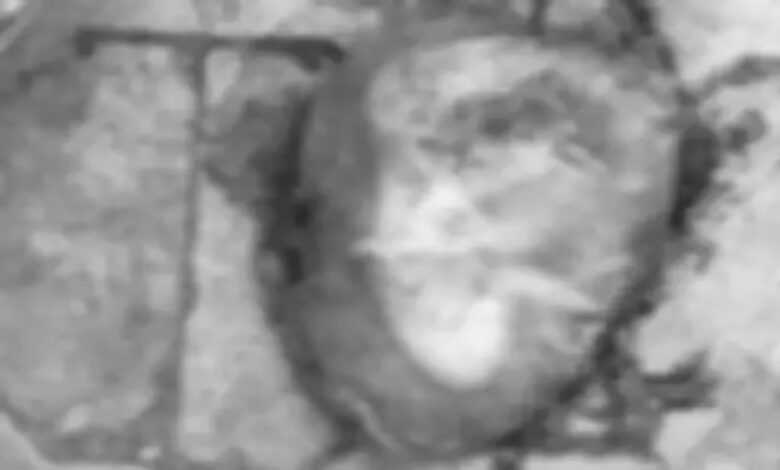 मेकाहारा रायपुर में कचरे के पास मिला भ्रूण: दो संदिग्ध CCTV में कैद, पुलिस जांच में जुटी