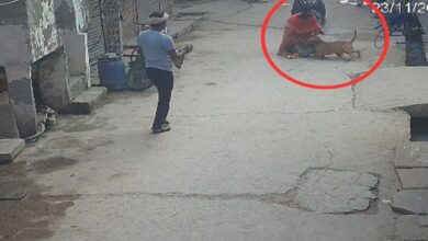 6-year-old boy seriously injured, ear severed in pitbull attack; CCTV video goes viral