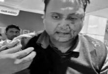 दिल्ली एयरपोर्ट पर पैसेंजर से मारपीट, पायलट सस्पेंड: यात्री ने सोशल मीडिया पर शेयर की आपबीती