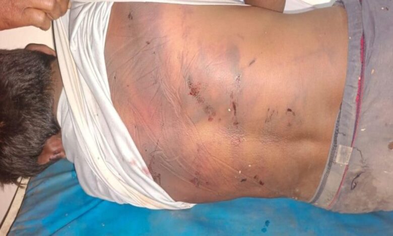 Young man kidnapped and brutally murdered, body dumped near his home; the incident has caused a sensation in the area.