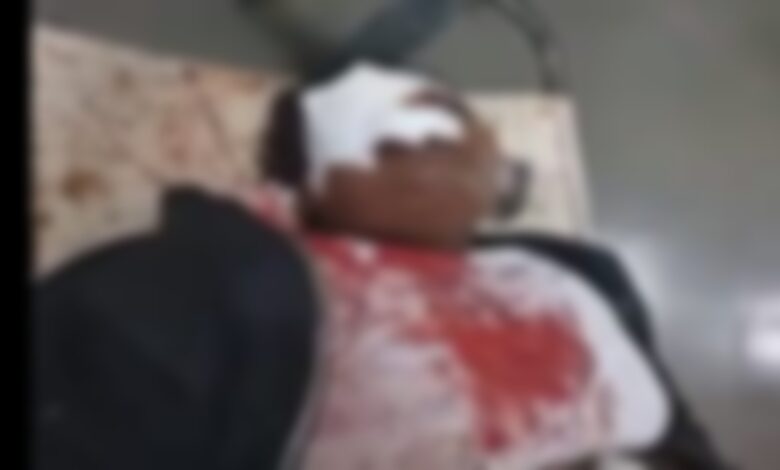 A young woman was hit on the head with a bottle in a beer bar; she died during treatment. Her family members surrounded the police station.