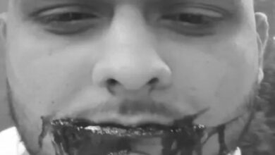 Chinese kite string wreaks havoc: Student's cheek cut in Raipur, requires 34 stitches, video goes viral.