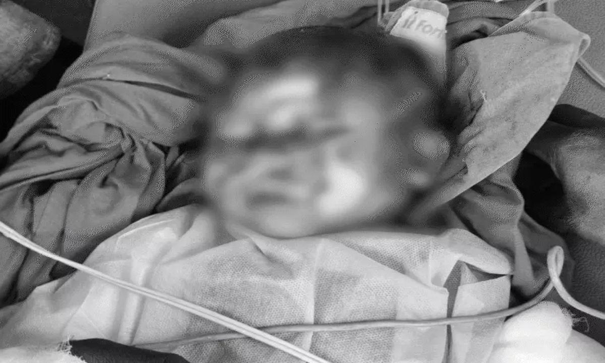 Raigarh Carbon Plant accident