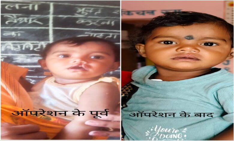 Chirayu Dal brought back the smile of innocent Ranjana