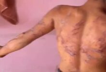 Tribal Youth Brutally Beaten at De-addiction Center; 'Torture Cell' Video Goes Viral