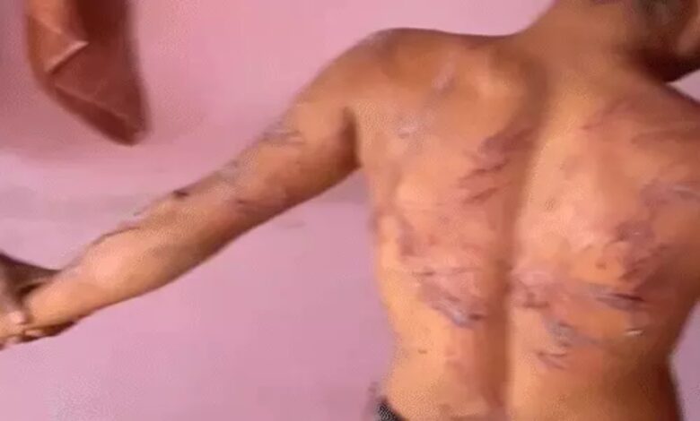 Tribal Youth Brutally Beaten at De-addiction Center; 'Torture Cell' Video Goes Viral