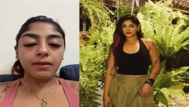 Splitsvilla Contestant Preet Singh Alleges Assault: Broken Tooth, Swollen Eyes