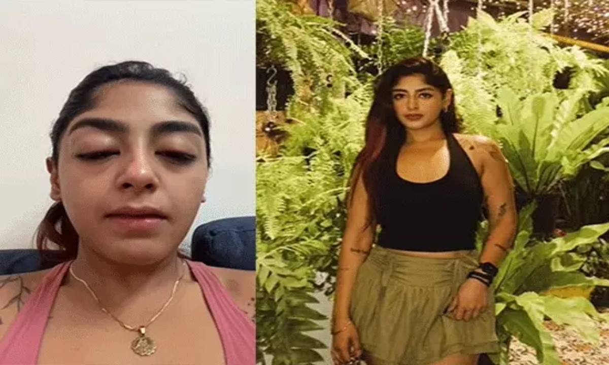 Splitsvilla Contestant Preet Singh Alleges Assault: Broken Tooth, Swollen Eyes