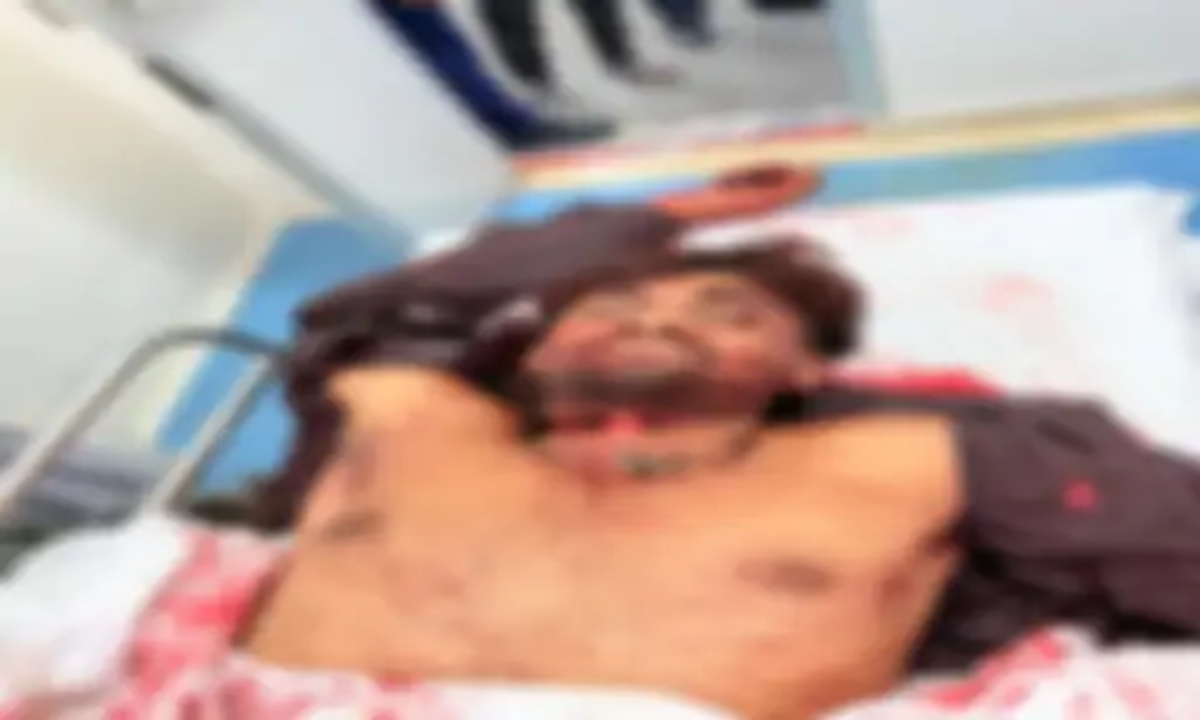 Brutal Murder of a Young Man in Bilaspur: Had Arrived to Save His Younger Brother; Assailants Slit His Throat with a Cleaver