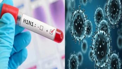 First case of swine flu in Durg