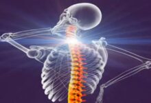 World Spine Day: Changing lifestyles are leading to an increase in back and neck pain